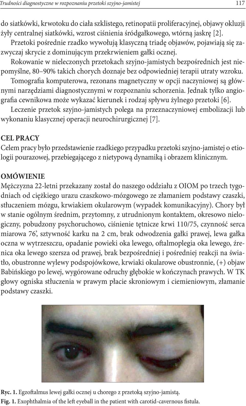 Rokowanie w nieleczonych przetokach szyjno-jamistych bezpośrednich jest niepomyślne, 80 90% takich chorych doznaje bez odpowiedniej terapii utraty wzroku.