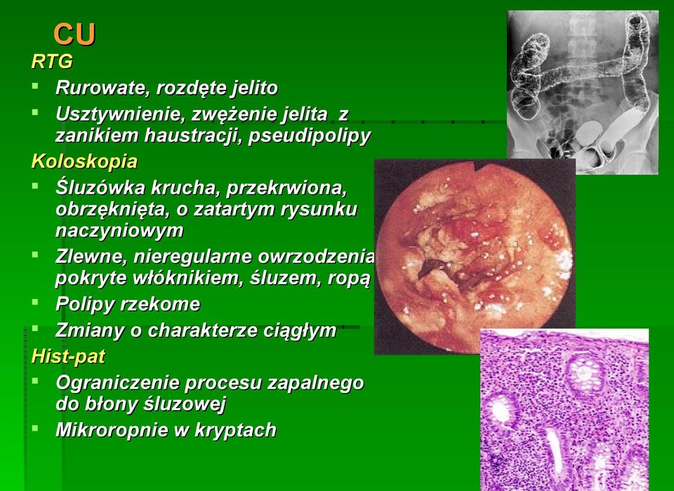 naczyniowym Zlewne, nieregularne owrzodzenia pokryte włóknikiem, śluzem, ropą Polipy rzekome