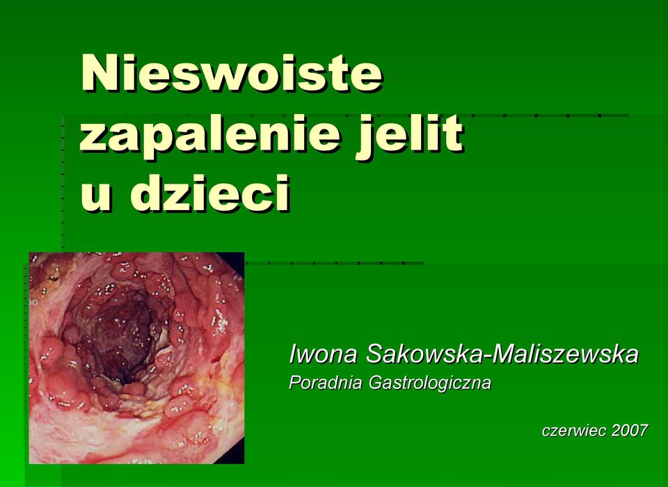 Sakowska-Maliszewska