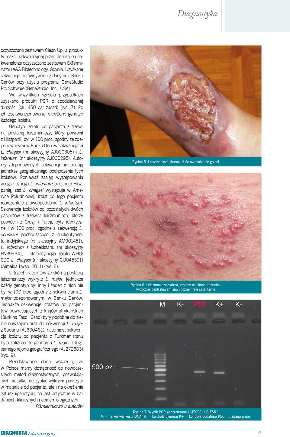 We wszystkich sześciu przypadkach uzyskano produkt PCR o spodziewanej długości (ok. 450 par zasad) (ryc. 7). Po ich zsekwencjonowaniu określono genotyp każdego izolatu.