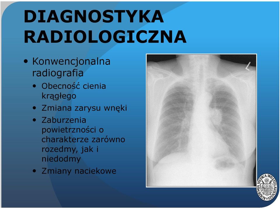 zarysu wnęki Zaburzenia powietrzności o