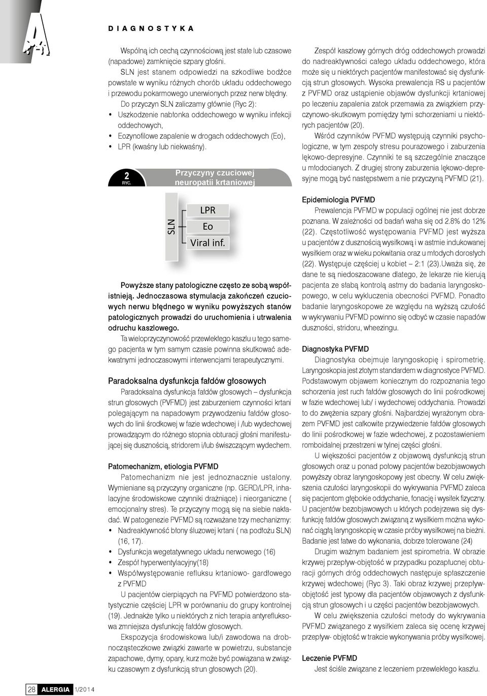 Do przyczyn SLN zaliczamy głównie (Ryc 2): Uszkodzenie nabłonka oddechowego w wyniku infekcji oddechowych, Eozynofilowe zapalenie w drogach oddechowych (Eo), LPR (kwaśny lub niekwaśny).