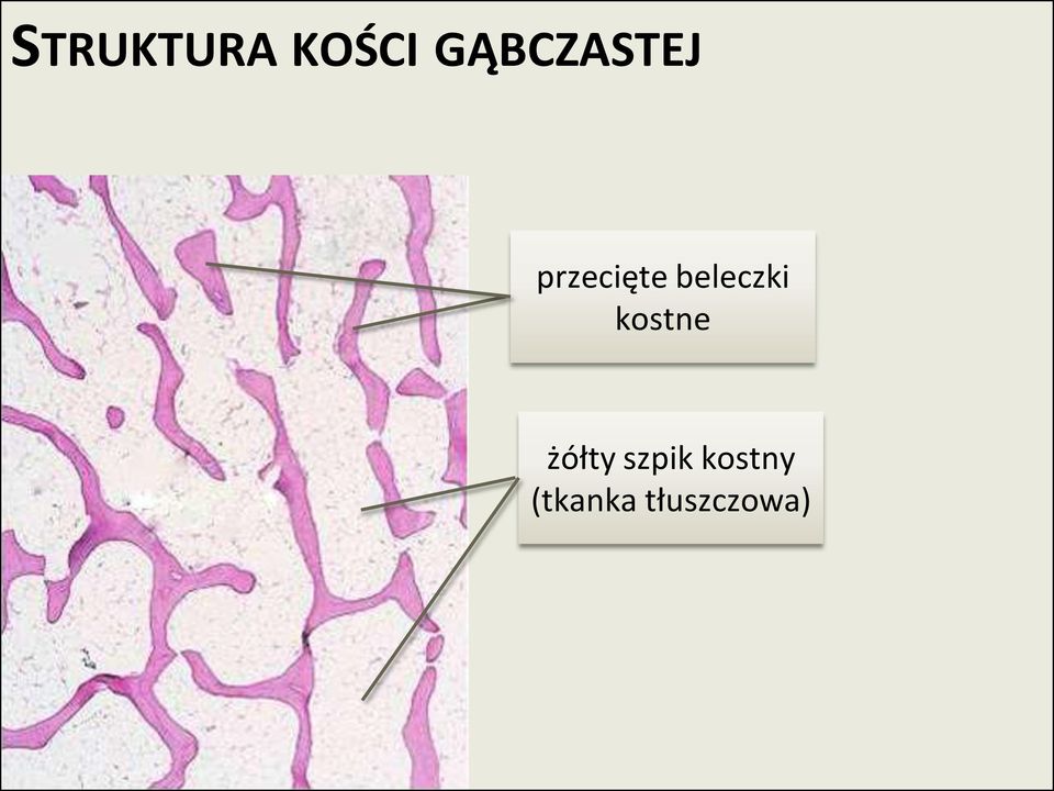 beleczki kostne żółty