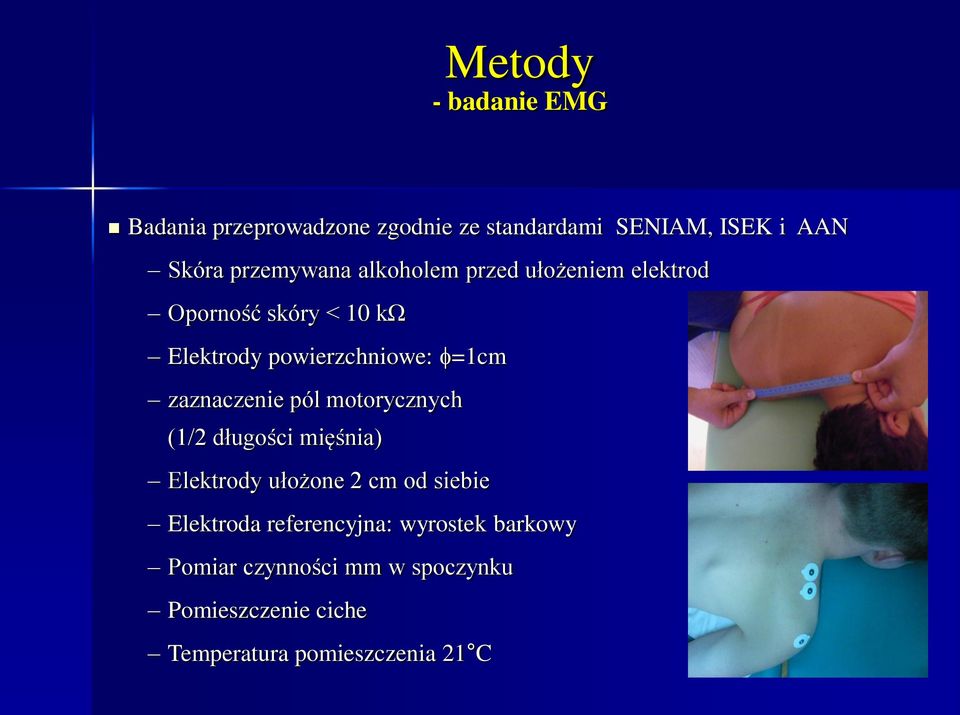 zaznaczenie pól motorycznych (1/2 długości mięśnia) Elektrody ułożone 2 cm od siebie Elektroda