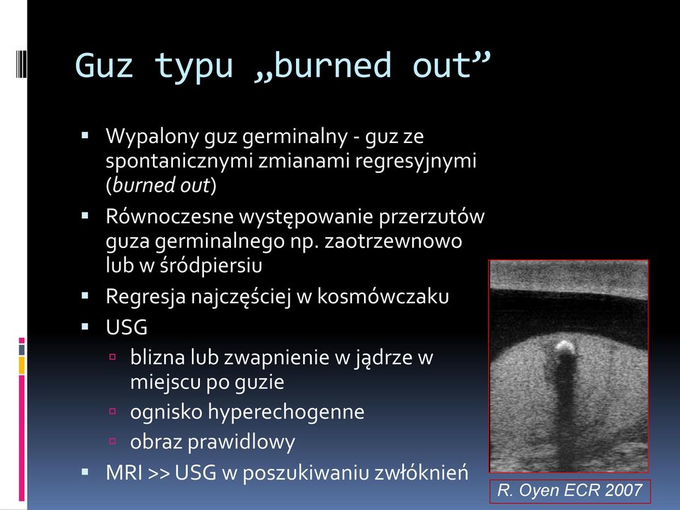 zaotrzewnowo lub w śródpiersiu Regresja najczęściej w kosmówczaku USG blizna lub zwapnienie w