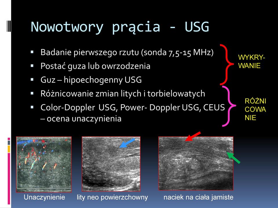 torbielowatych Color-Doppler USG, Power- Doppler USG, CEUS ocena unaczynienia