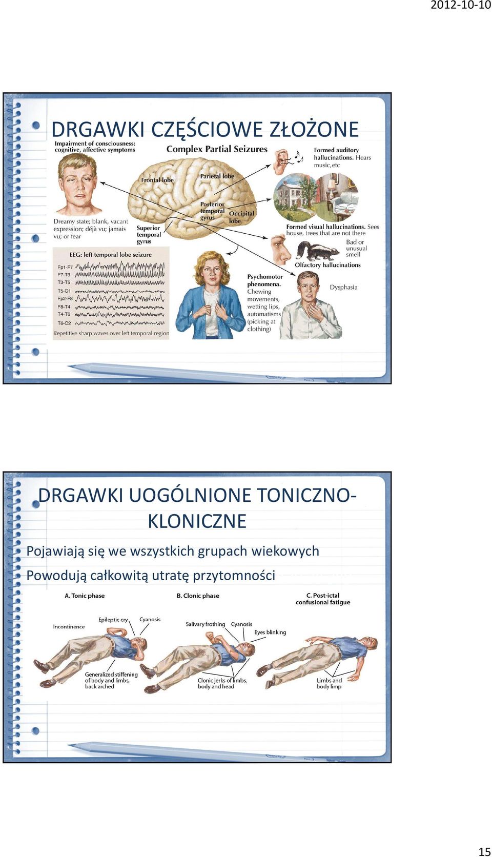 utratę przytomnościrsin all age groups Involves complete loss of