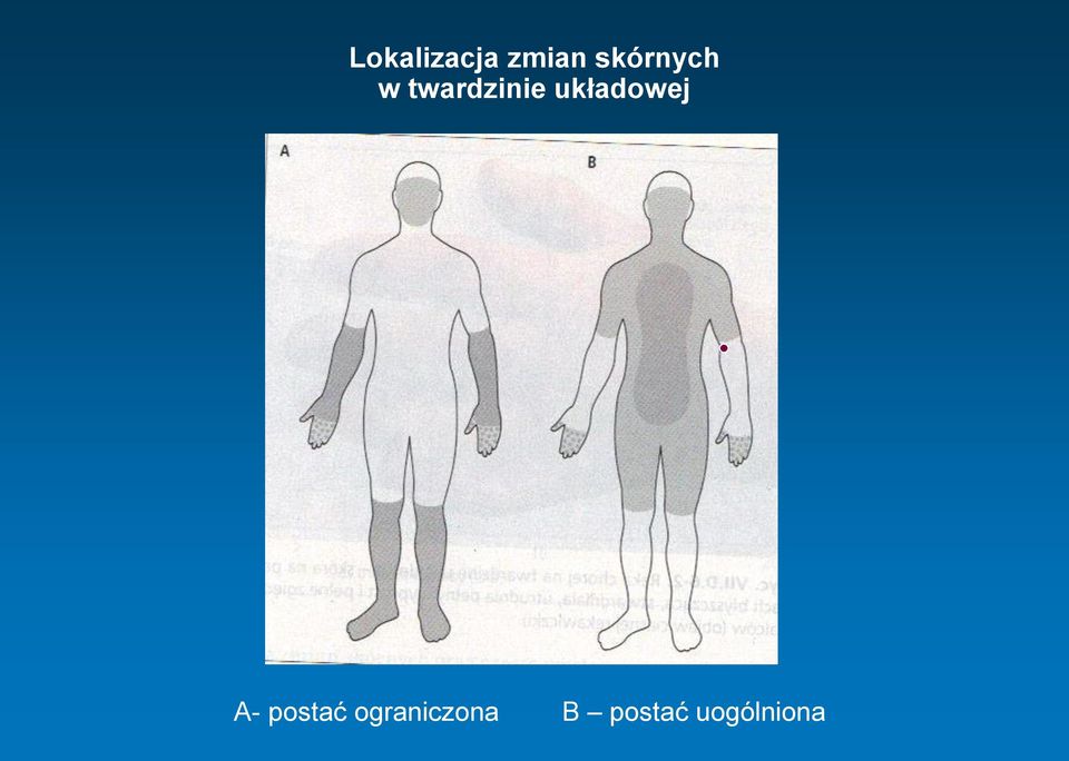 układowej A- postać