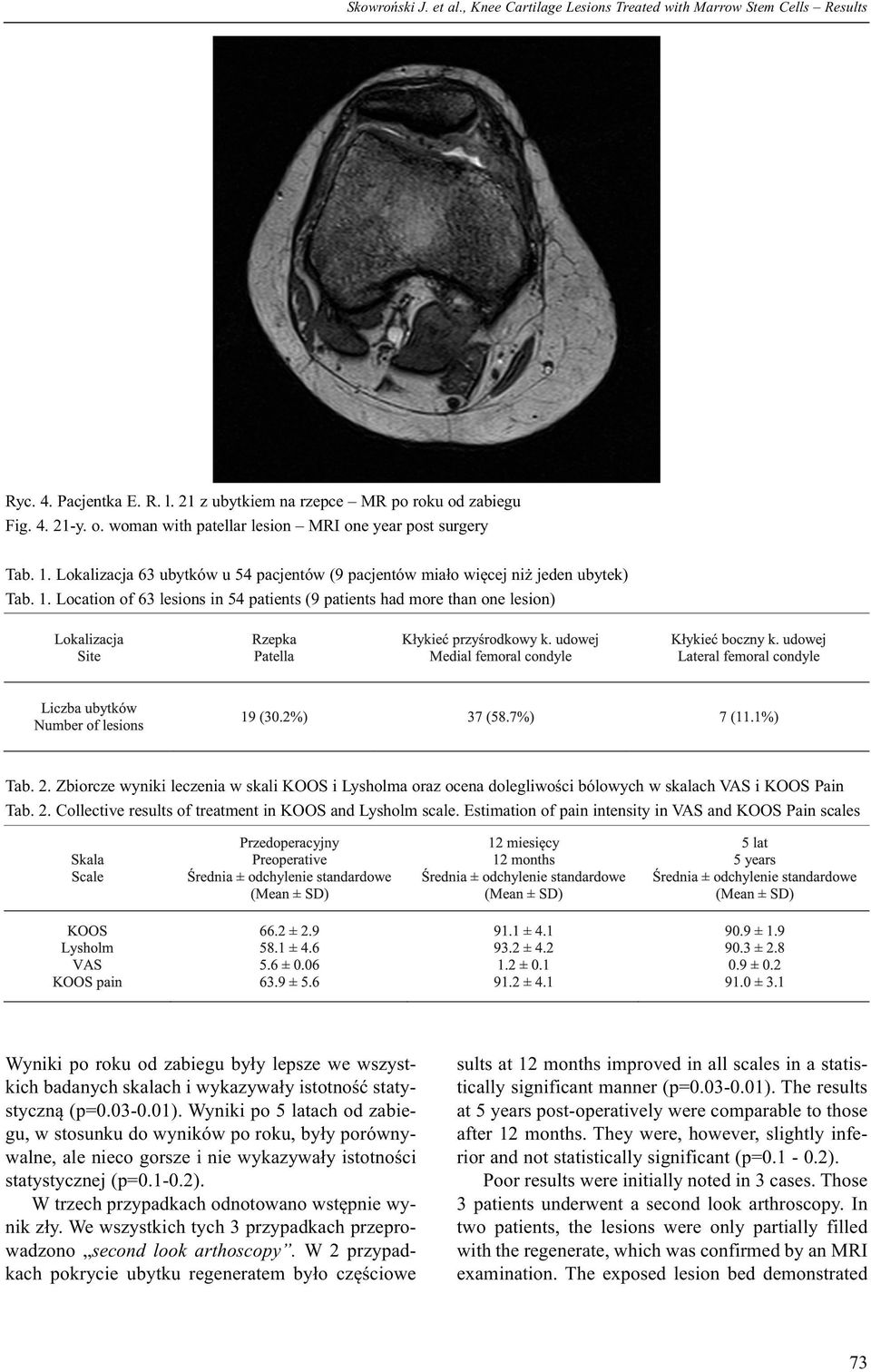 2. Zbiorcze wyniki leczenia w skali KOOS i Lysholma oraz ocena dolegliwości bólowych w skalach VAS i KOOS Pain Tab. 2. Collective results of treatment in KOOS and Lysholm scale.