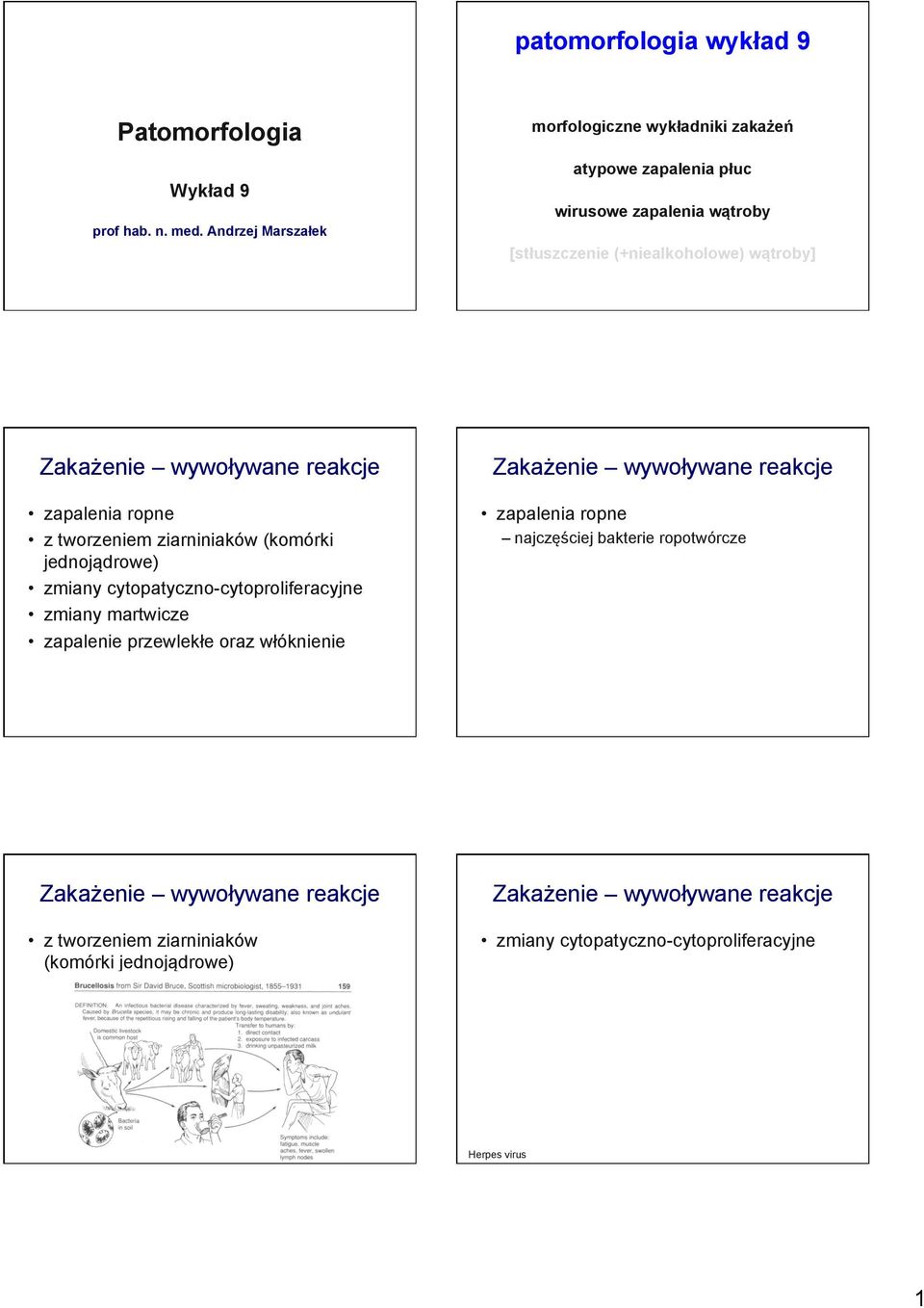 (+niealkoholowe) wątroby] zapalenia ropne z tworzeniem ziarniniaków (komórki jednojądrowe) zmiany