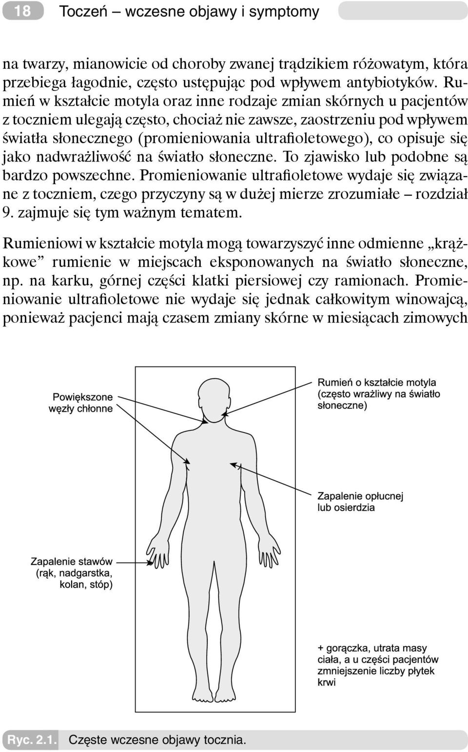 opisuje się jako nadwrażliwość na światło słoneczne. To zjawisko lub podobne są bardzo powszechne.
