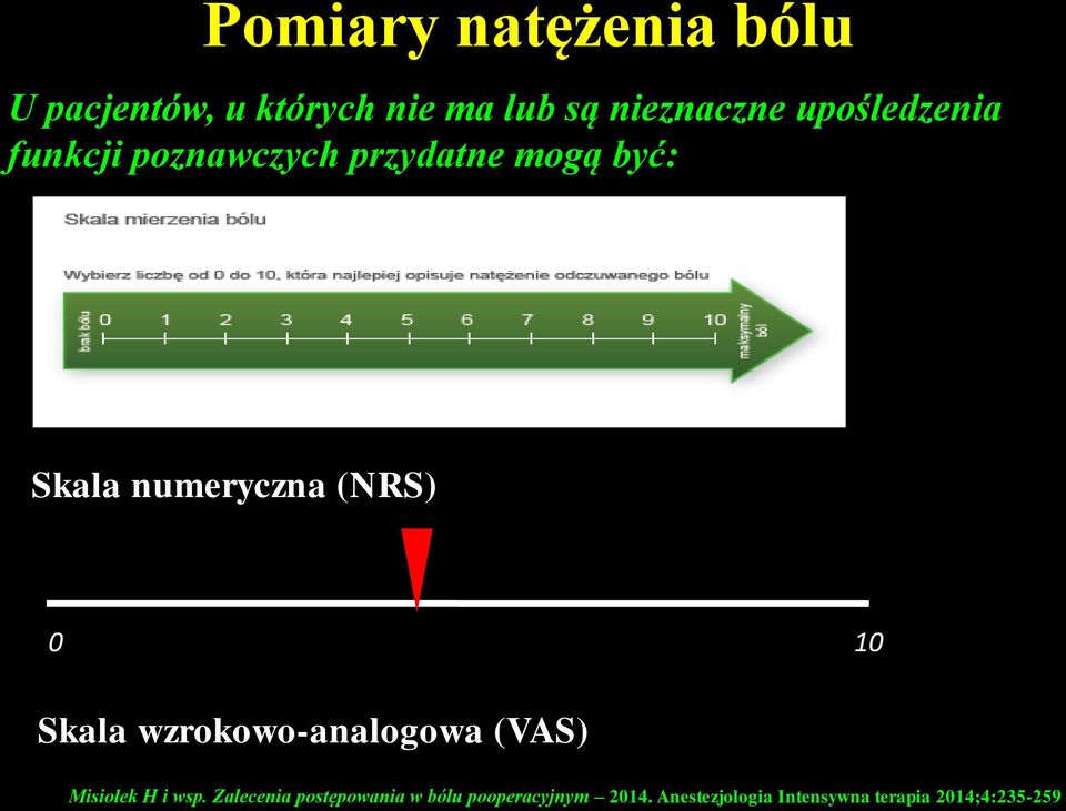 bólu Ból nie do zniesienia 0 10 Skala wzrokowo-analogowa (VAS) Misiołek H i wsp.