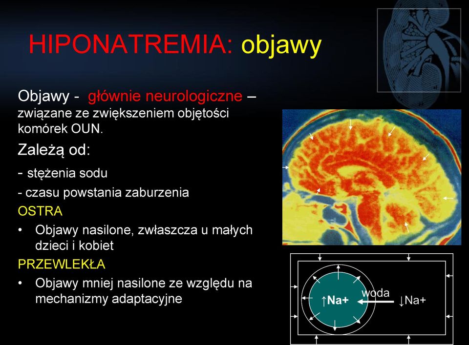 Zależą od: - stężenia sodu - czasu powstania zaburzenia OSTRA Objawy
