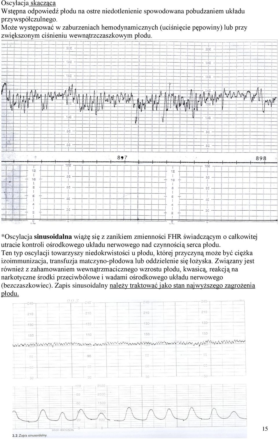 *Oscylacja sinusoidalna wiążę się z zanikiem zmienności FHR świadczącym o całkowitej utracie kontroli ośrodkowego układu nerwowego nad czynnością serca płodu.