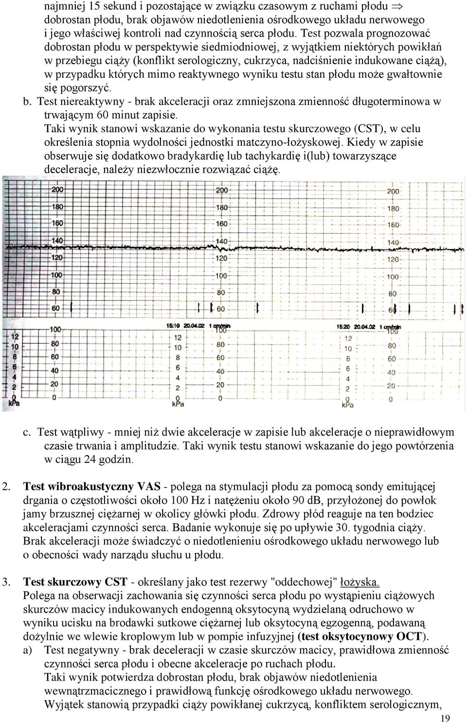 których mimo reaktywnego wyniku testu stan płodu może gwałtownie się pogorszyć. b. Test niereaktywny - brak akceleracji oraz zmniejszona zmienność długoterminowa w trwającym 60 minut zapisie.