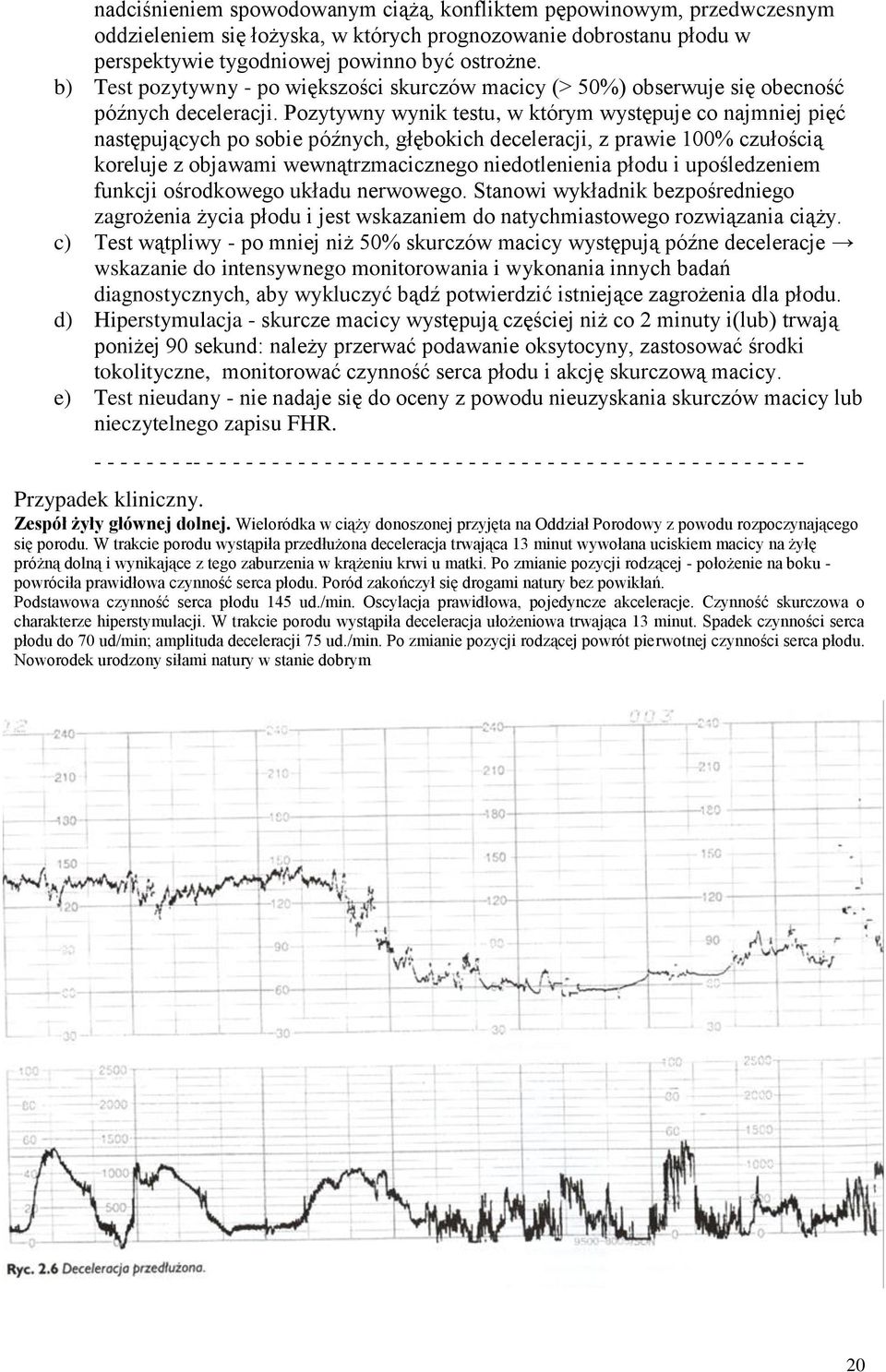 Pozytywny wynik testu, w którym występuje co najmniej pięć następujących po sobie późnych, głębokich deceleracji, z prawie 100% czułością koreluje z objawami wewnątrzmacicznego niedotlenienia płodu i