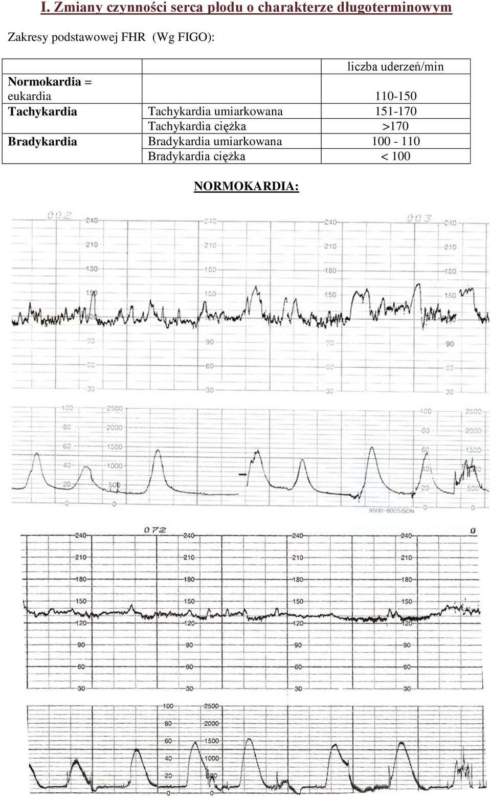 110-150 Tachykardia Tachykardia umiarkowana 151-170 Tachykardia ciężka