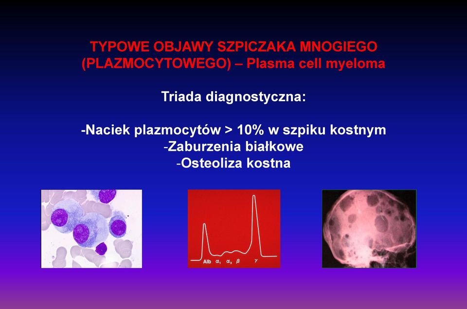 diagnostyczna: -Naciek plazmocytów > 10% w