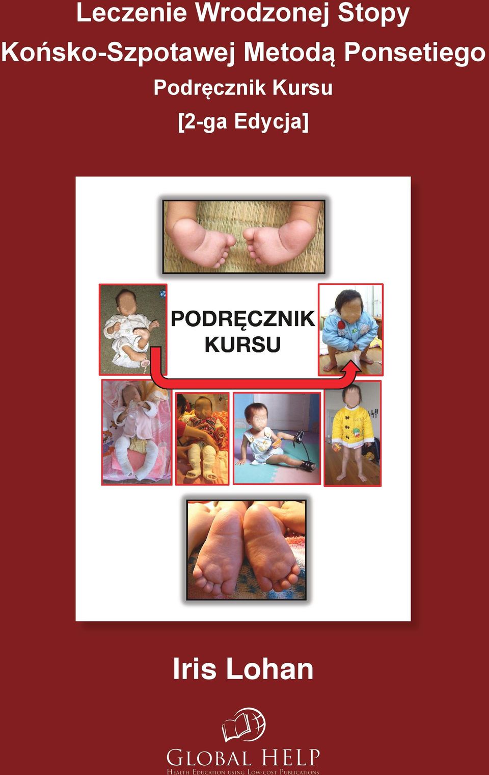 Ponsetiego Podręcznik