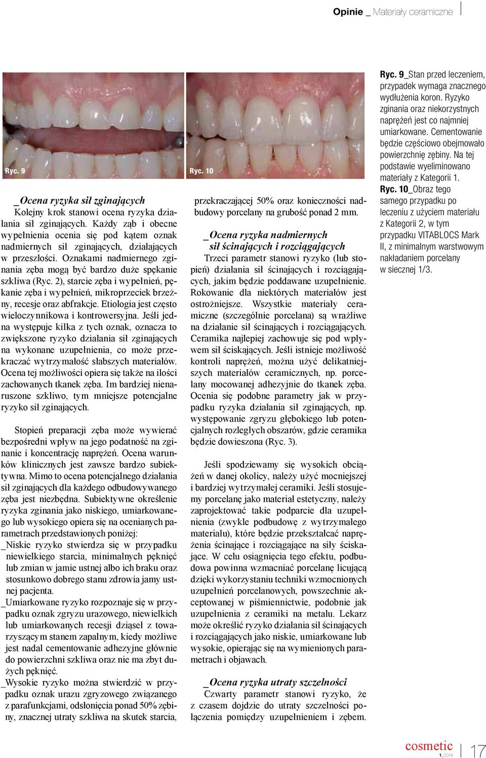 2), starcie zęba i wypełnień, pękanie zęba i wypełnień, mikroprzeciek brzeżny, recesje oraz abfrakcje. Etiologia jest często wieloczynnikowa i kontrowersyjna.