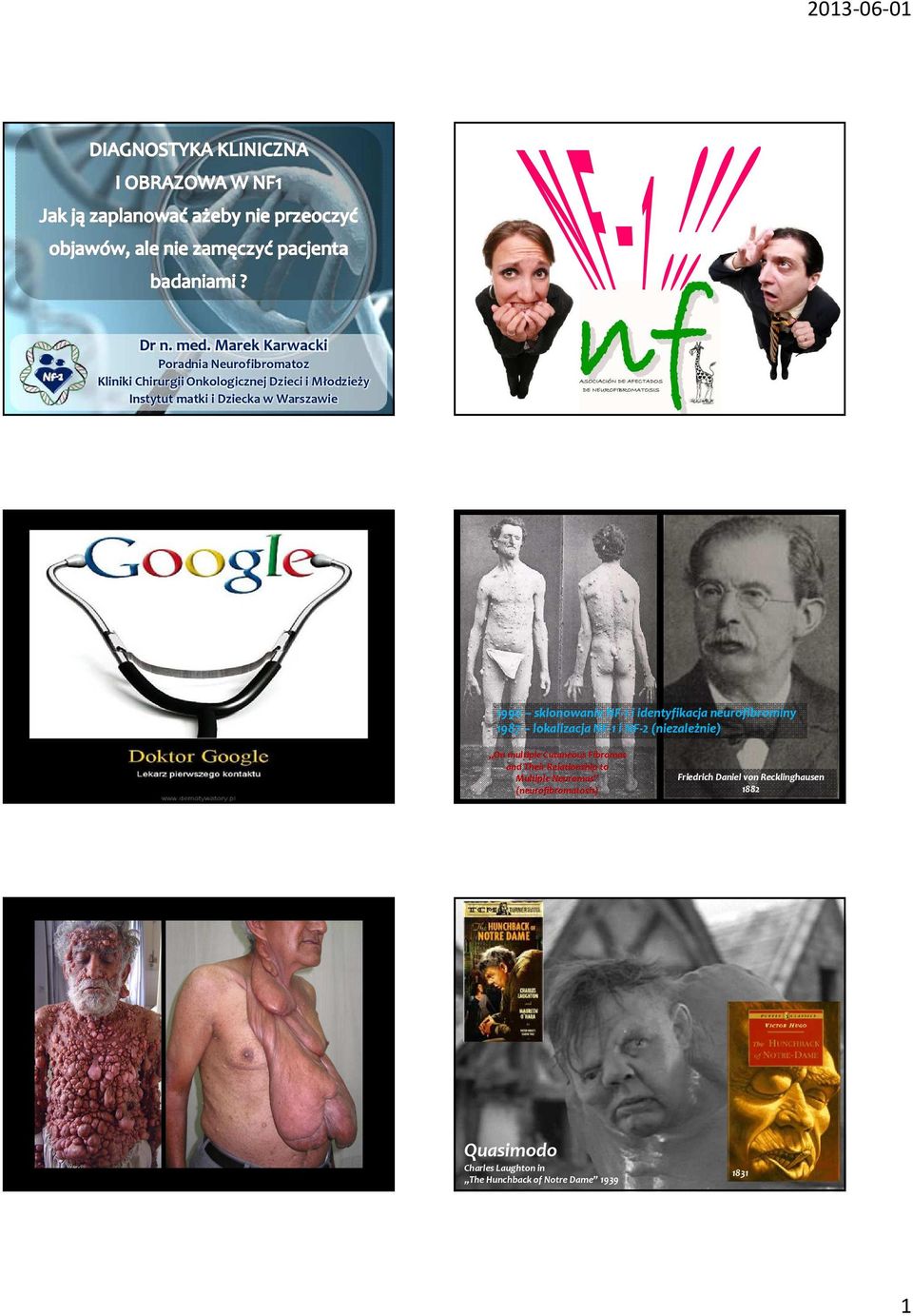 Dziecka w Warszawie 1990 sklonowanie NF-1 i identyfikacja neurofibrominy 1987 lokalizacja NF-1 i