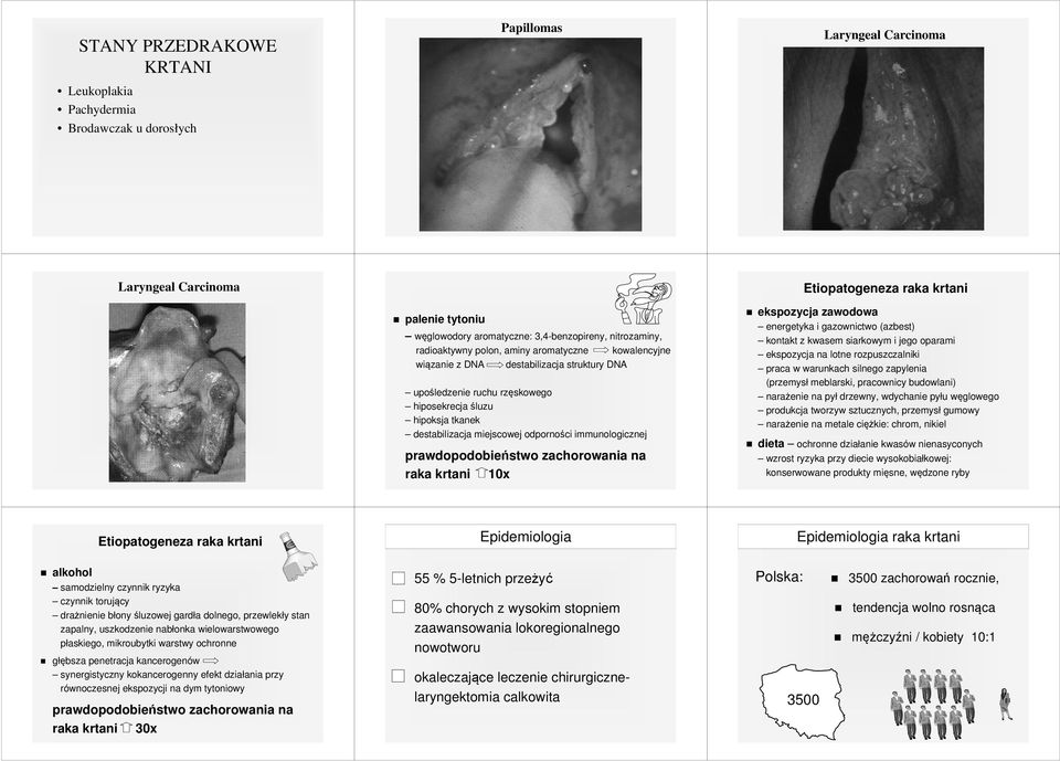 destabilizacja miejscowej odporności immunologicznej prawdopodobieństwo zachorowania na raka krtani 10x Etiopatogeneza raka krtani alkohol samodzielny czynnik ryzyka czynnik torujący drażnienie błony