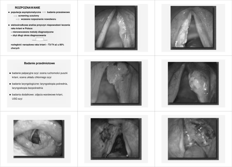 narządowa raka krtani T3-T4 aż u 80% chorych Badanie przedmiotowe badanie palpacyjne szyi: ocena ruchomości puszki krtani, ocena układu