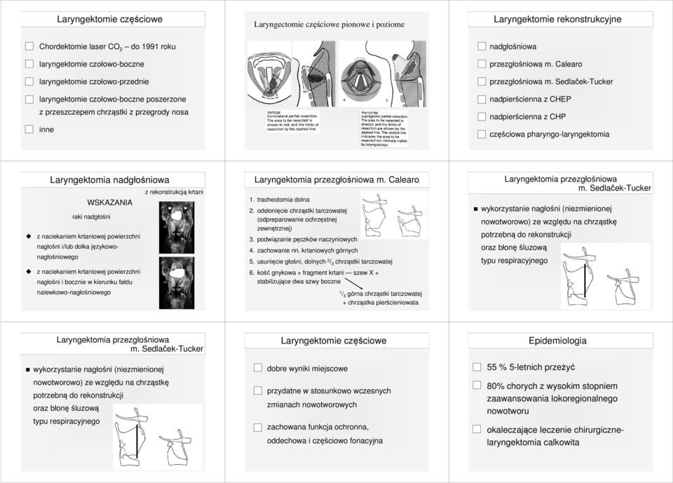 Sedlaček-Tucker nadpierścienna z CHEP nadpierścienna z CHP częściowa pharyngo-laryngektomia Laryngektomia nadgłośniowa z rekonstrukcją krtani WSKAZANIA raki nadgłośni z naciekaniem krtaniowej