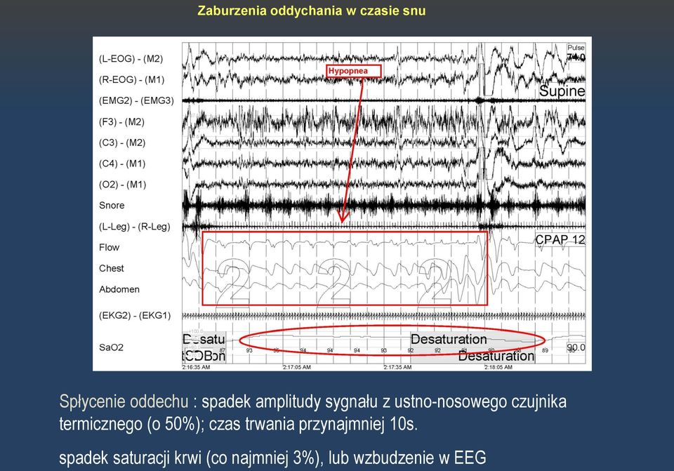 termicznego (o 50%); czas trwania przynajmniej 10s.