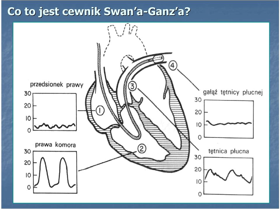 cewnik
