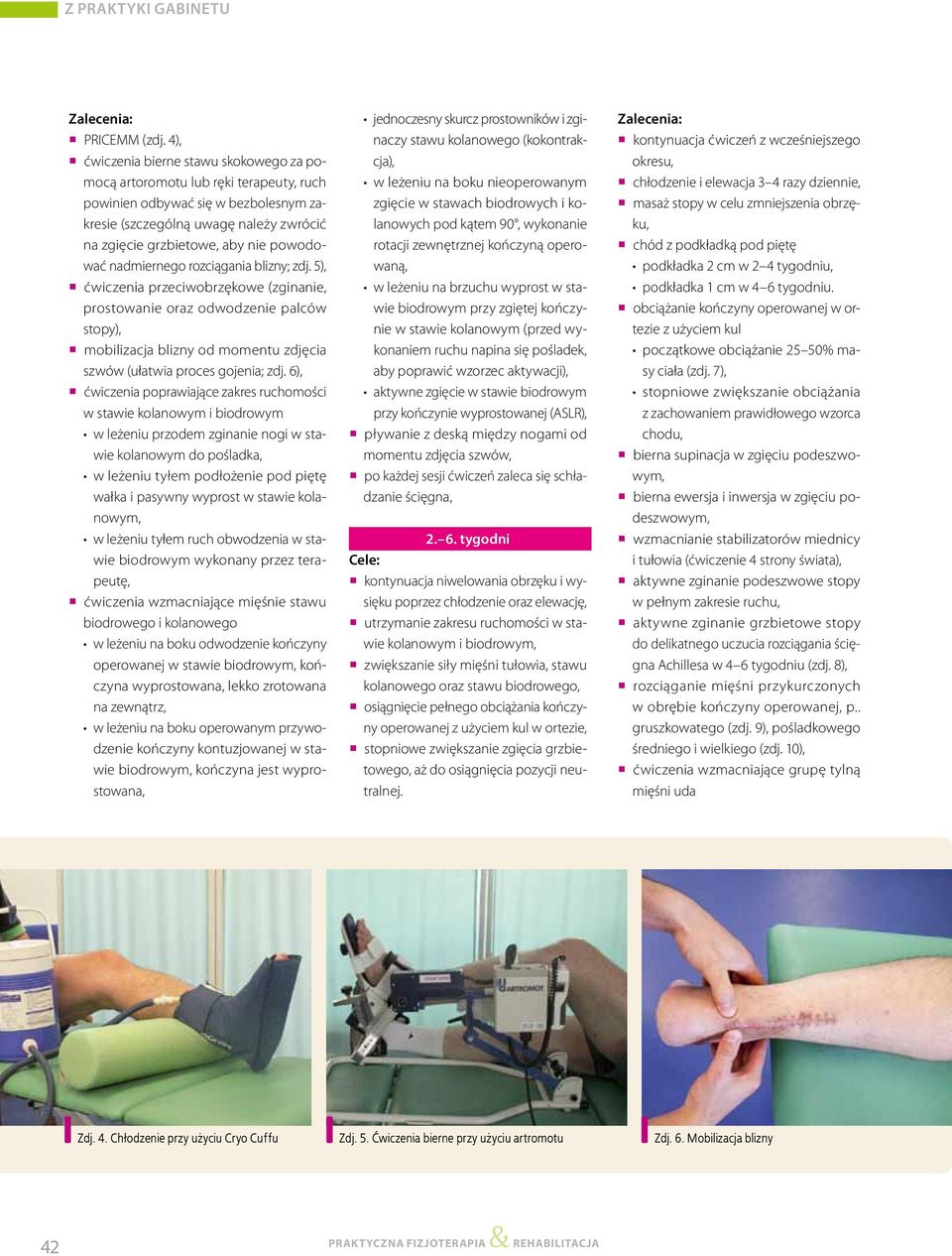 powodować nadmiernego rozciągania blizny; zdj.