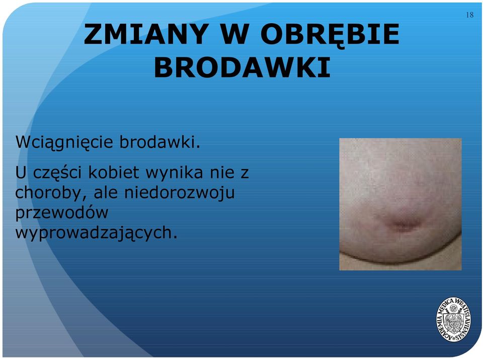 U części kobiet wynika nie z