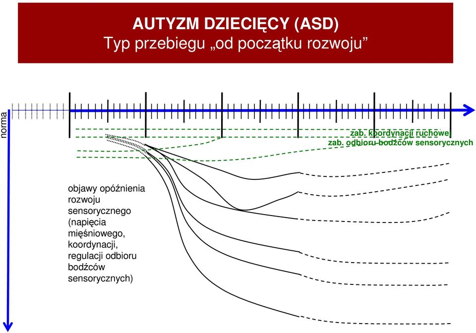 odbioru bodźców sensorycznych objawy opóźnienia rozwoju