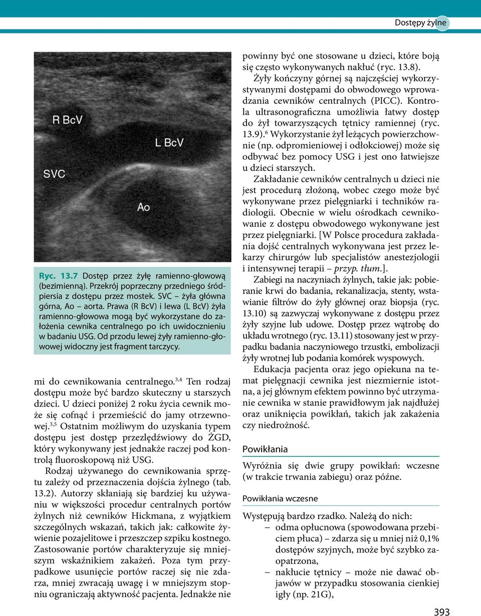 Od przodu lewej żyły ramienno-głowowej widoczny jest fragment tarczycy. mi do cewnikowania centralnego. 3,4 Ten rodzaj dostępu może być bardzo skuteczny u starszych dzieci.