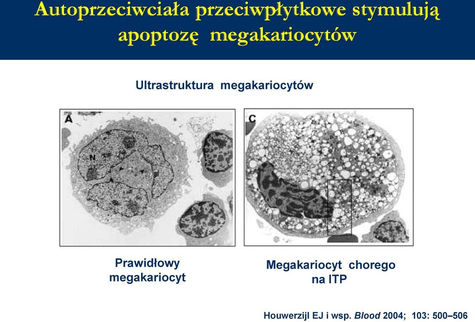 megakariocytów Prawidłowy megakariocyt