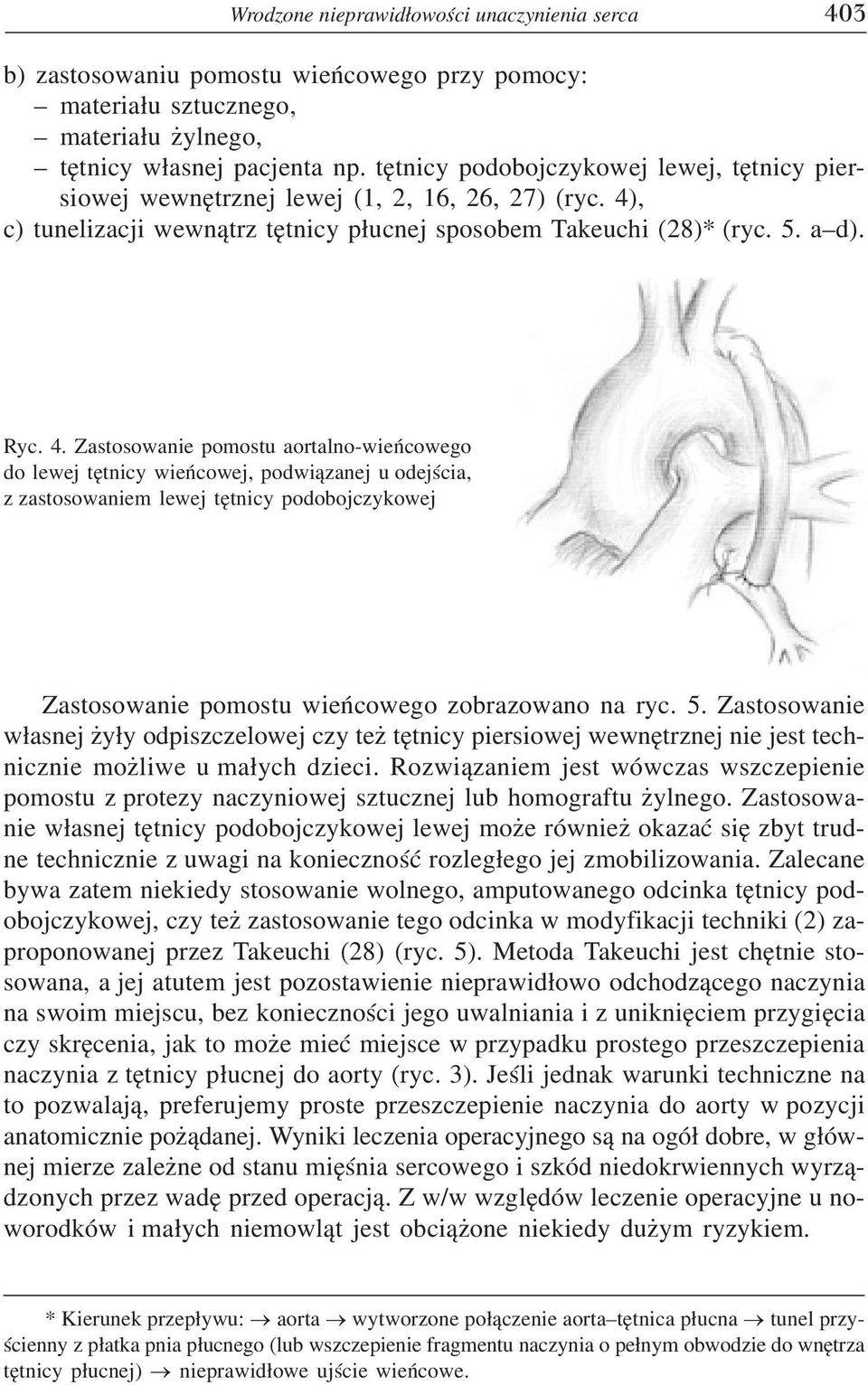 , c) tunelizacji wewn¹trz têtnicy p³ucnej sposobem Takeuchi (28)* (ryc. 5. a d). Ryc. 4.