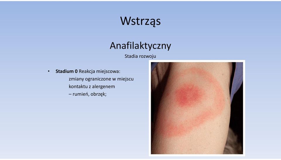 miejscowa: zmiany ograniczone w