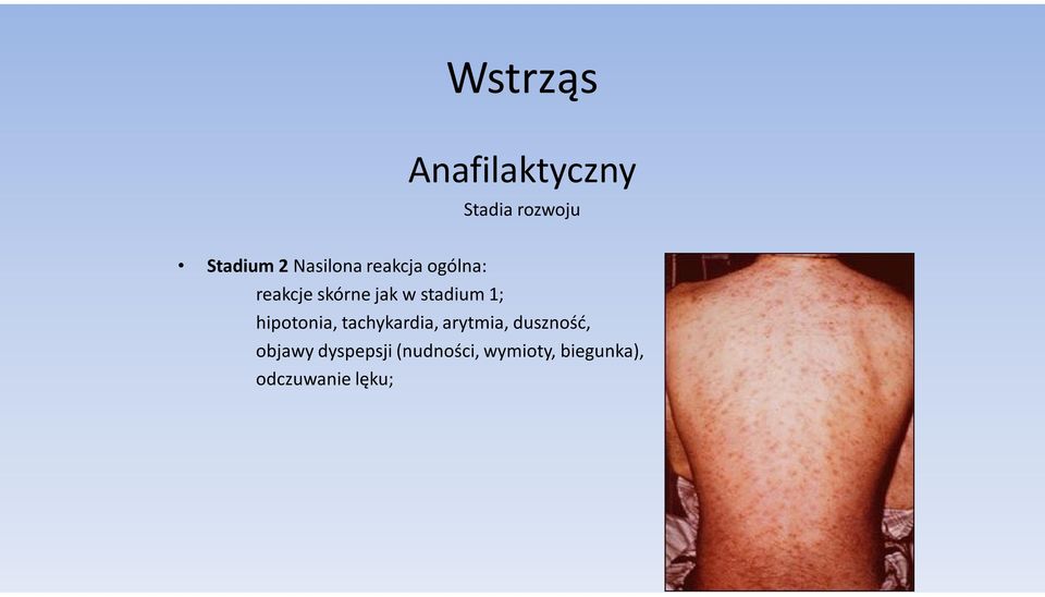 stadium 1; hipotonia, tachykardia, arytmia,