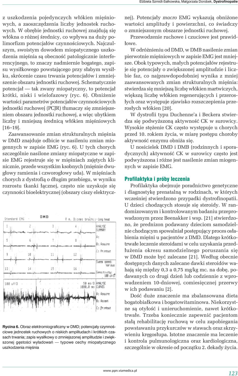 wyładowań typowe cechy miopatycznego uszkodzenia mięśnia z uszkodzenia pojedynczych włókien mięśniowych, a zaoszczędzenia liczby jednostek ruchowych.