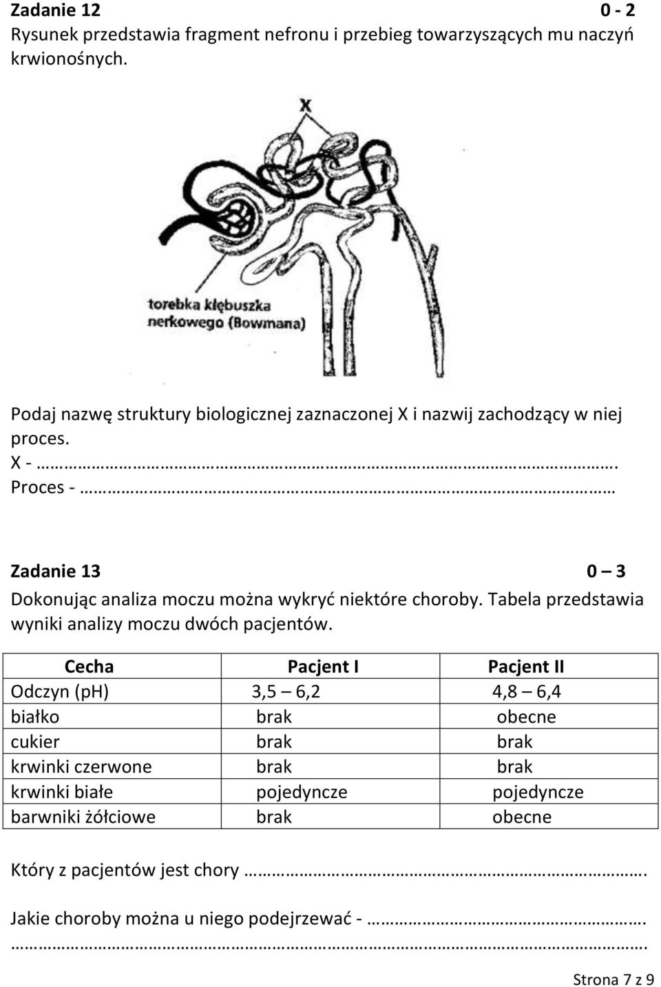 Proces - Zadanie 13 0 3 Dokonując analiza moczu można wykryd niektóre choroby. Tabela przedstawia wyniki analizy moczu dwóch pacjentów.