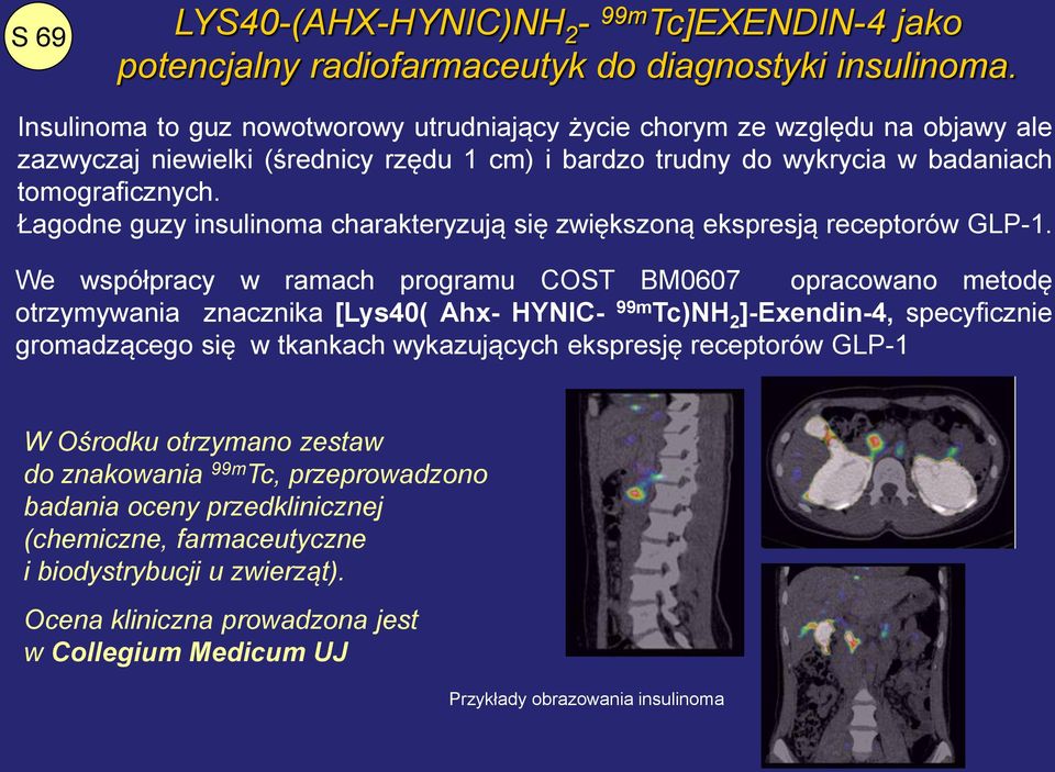 Łagodne guzy insulinoma charakteryzują się zwiększoną ekspresją receptorów GLP-1.