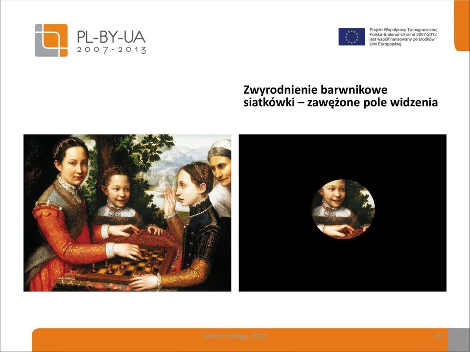 siatkówki zawężone