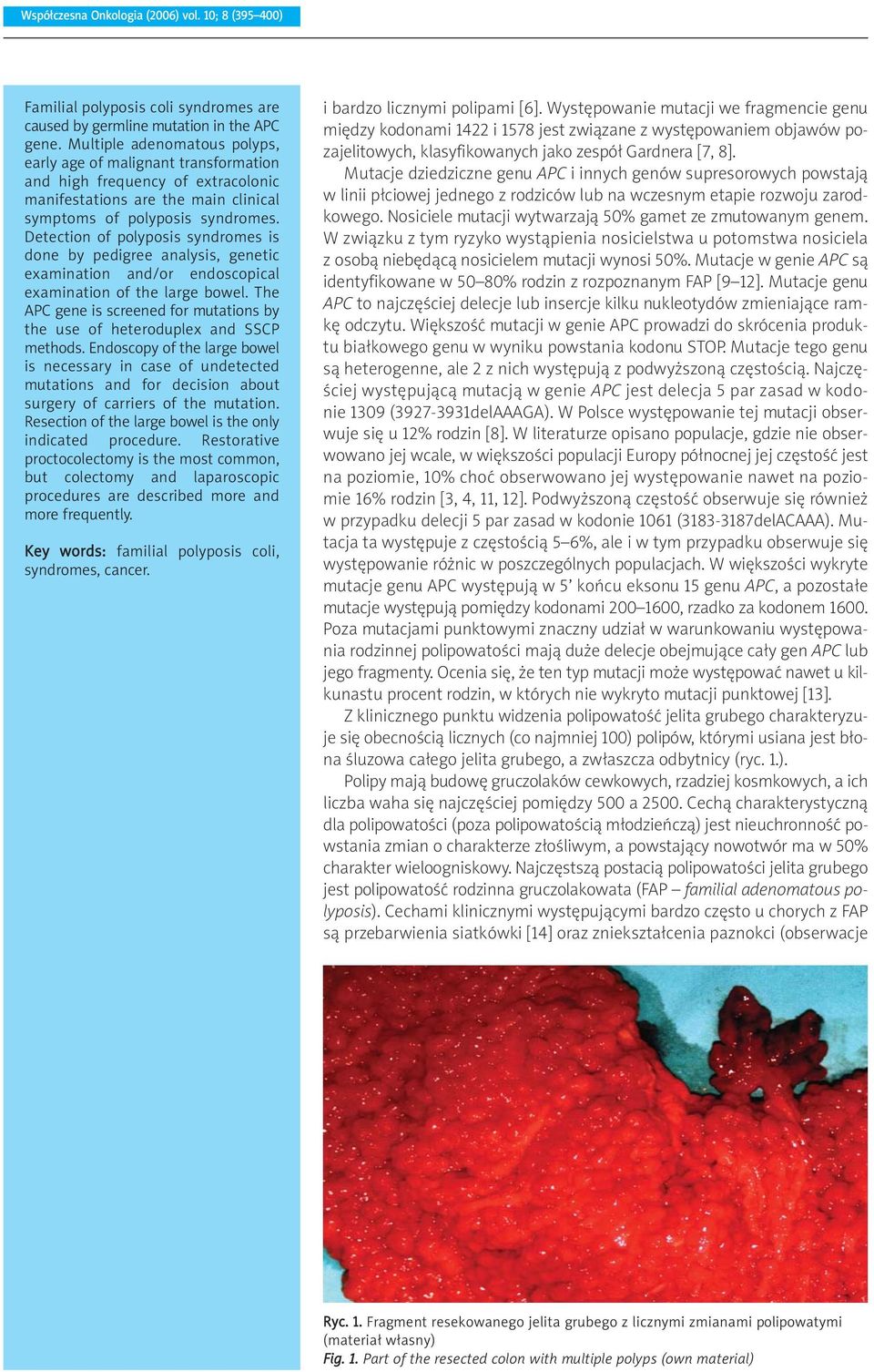 Detection of polyposis syndromes is done by pedigree analysis, genetic examination and/or endoscopical examination of the large bowel.