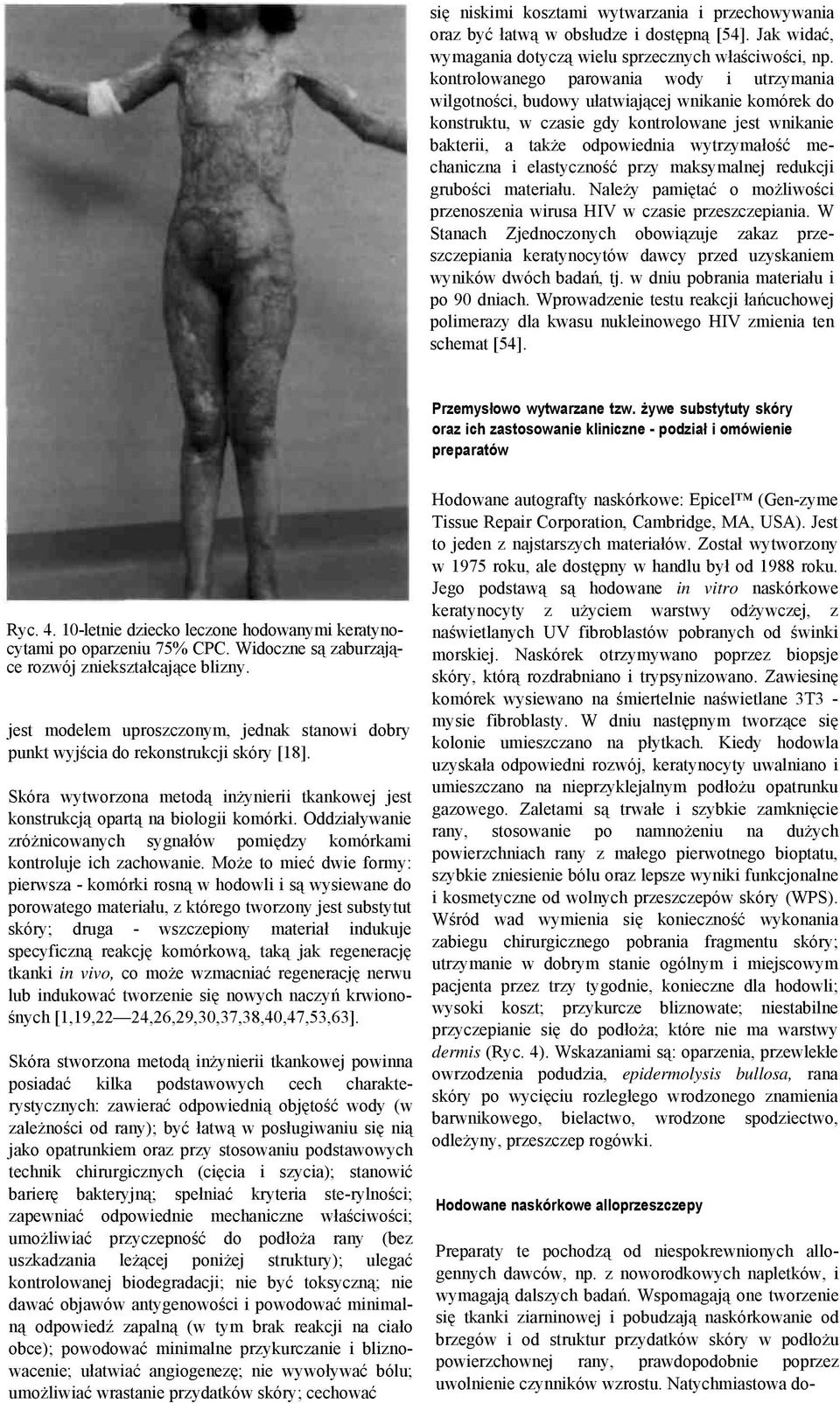 mechaniczna i elastyczność przy maksymalnej redukcji grubości materiału. Należy pamiętać o możliwości przenoszenia wirusa HIV w czasie przeszczepiania.