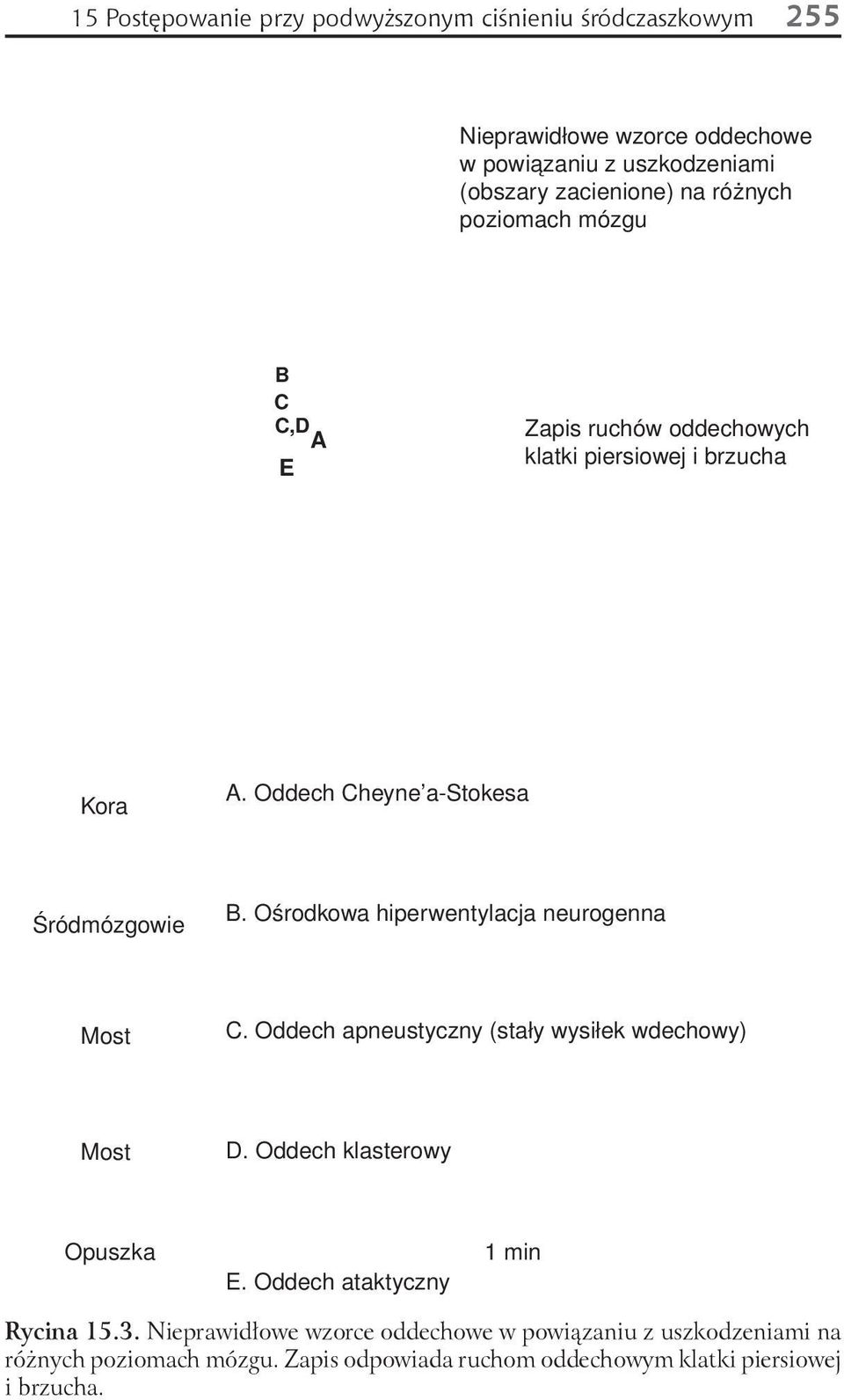 Ośrodkowa hiperwentylacja neurogenna Most C. Oddech apneustyczny (stały wysiłek wdechowy) Most D. Oddech klasterowy Opuszka E.