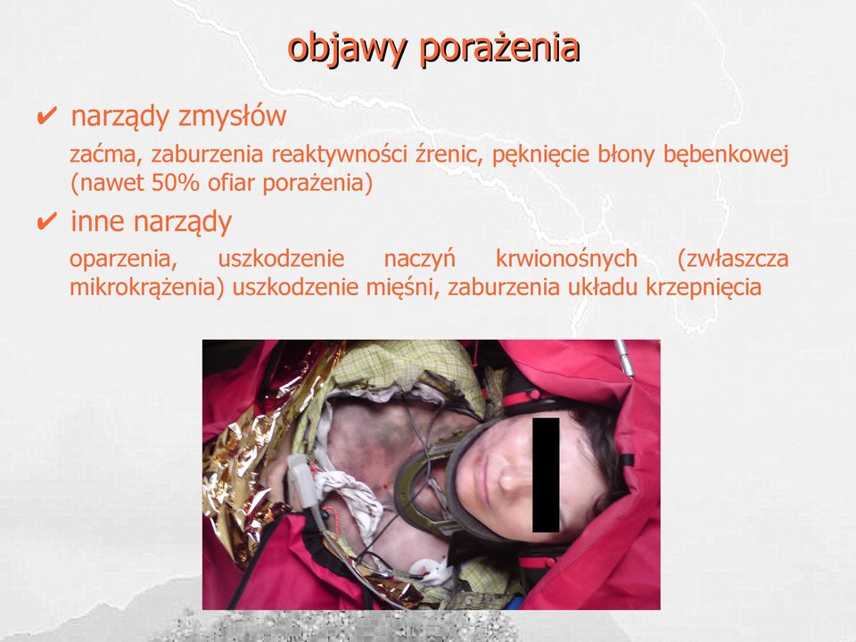 inne narządy oparzenia, uszkodzenie naczyń krwionośnych