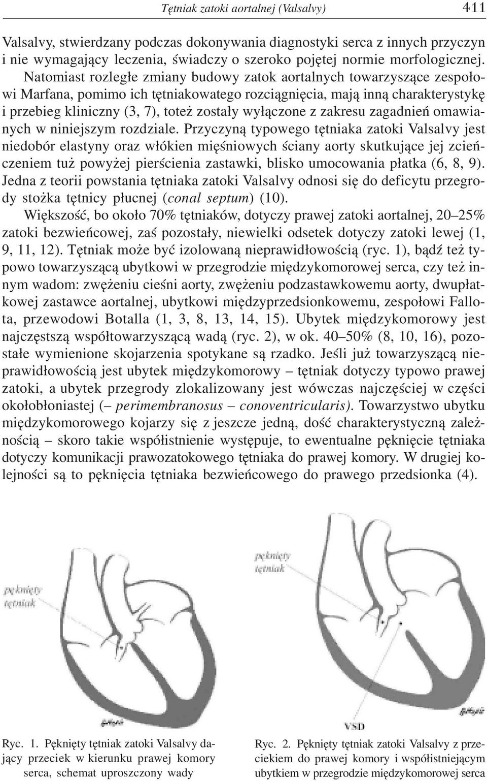 wy³¹czone z zakresu zagadnieñ omawianych w niniejszym rozdziale.