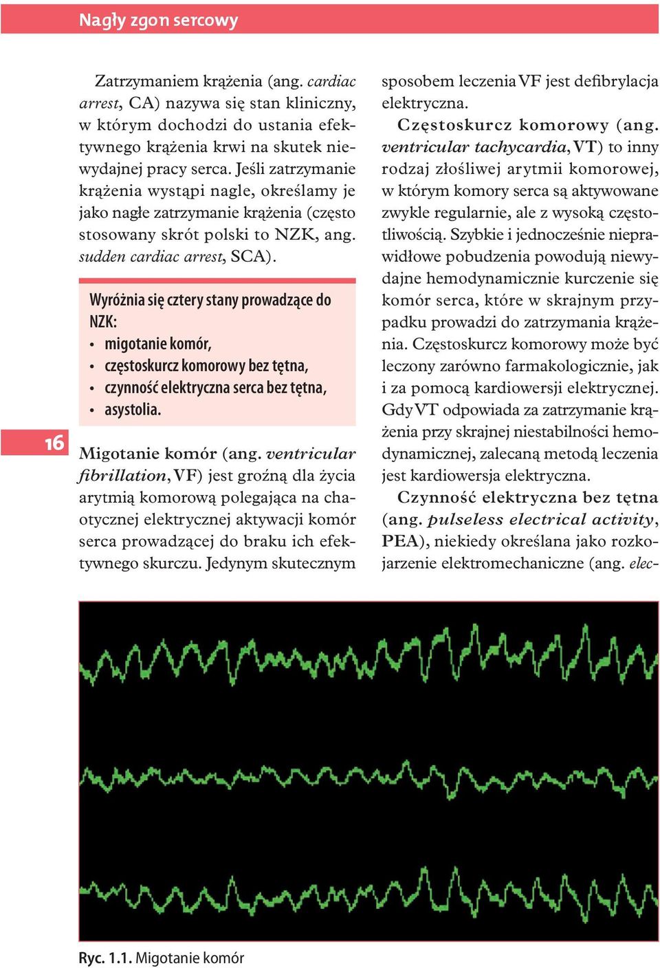 Wyróżnia się cztery stany prowadzące do NZK: migotanie komór, częstoskurcz komorowy bez tętna, czynność elektryczna serca bez tętna, asystolia. Migotanie komór (ang.