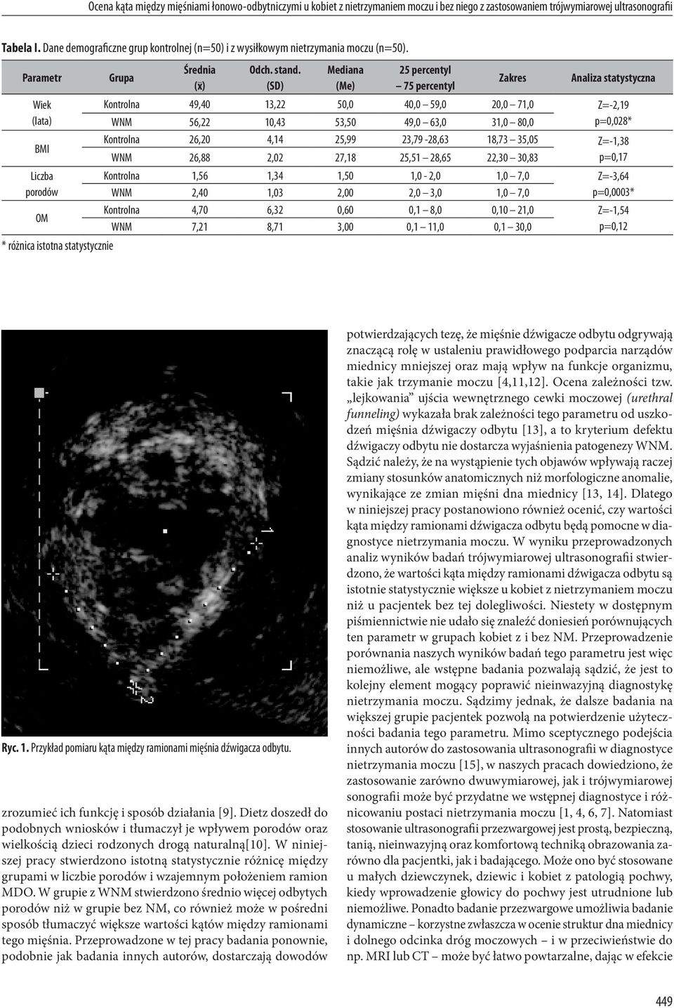 (Sd) Mediana (Me) 25 percentyl 75 percentyl Zakres Analiza statystyczna Kontrolna 49,40 13,22 50,0 40,0 59,0 20,0 71,0 Z=-2,19 WNM 56,22 10,43 53,50 49,0 63,0 31,0 80,0 p=0,028* Kontrolna 26,20 4,14