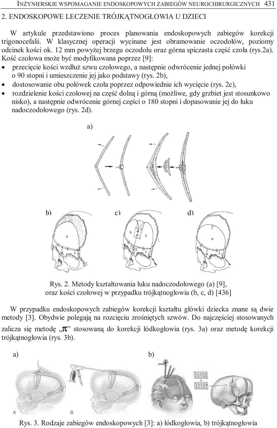 W klasycznej operacji wycinane jest obramowanie oczodołów, poziomy odcinek kości ok. 12 mm powyżej brzegu oczodołu oraz górna spiczasta część czoła (rys.2a).